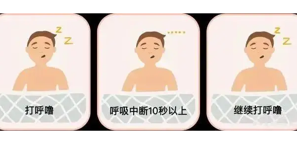 你真的了解睡眠呼吸暫停嗎？6600萬中重度患者正在受害！—仟龍醫(yī)療