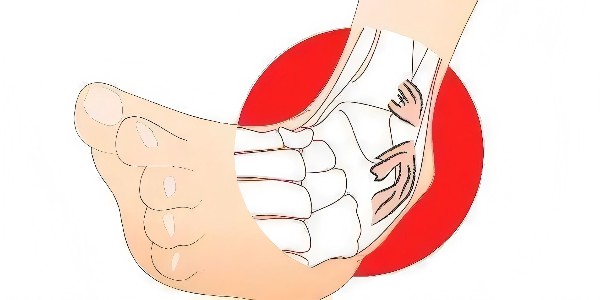 踝關(guān)節(jié)扭傷后的最佳應(yīng)對(duì)指南：簡(jiǎn)單四步，助力快速康復(fù)！