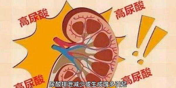 突然痛風？別再只怪啤酒和燒烤！真正的“尿酸元兇”遠比你想的多！